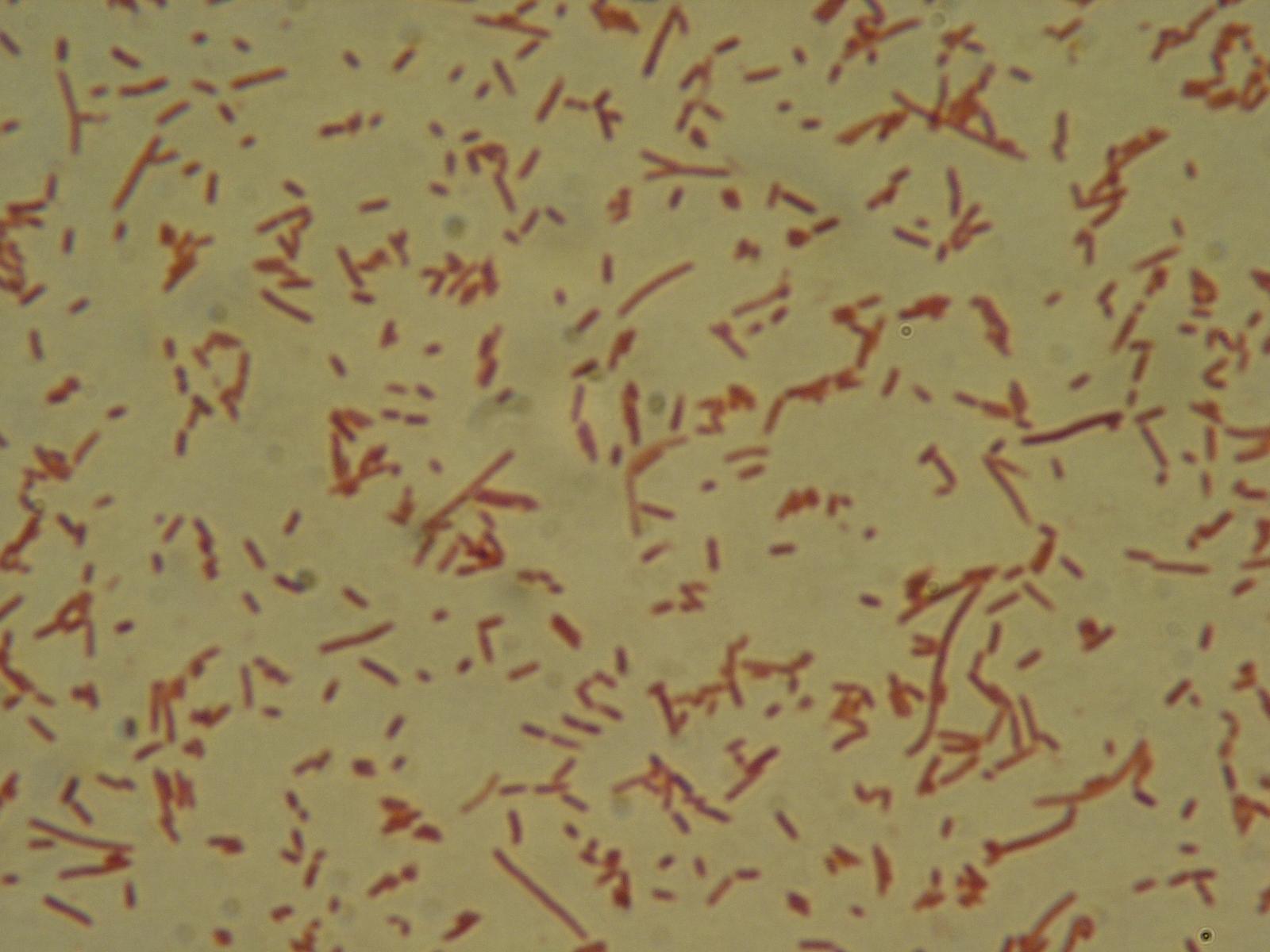 Сколько ангелов на кончике иглы. Escherichia coli в микроскопе.
